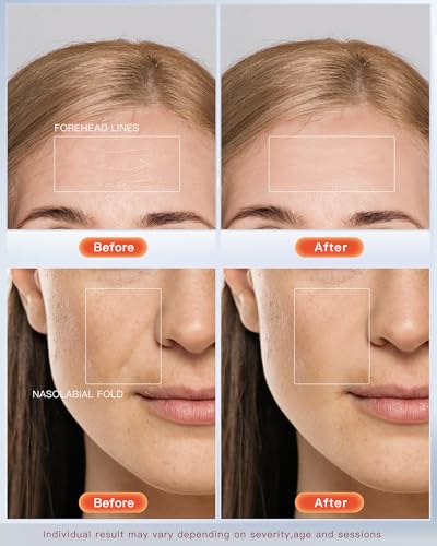LED Face Mask Light Therapy