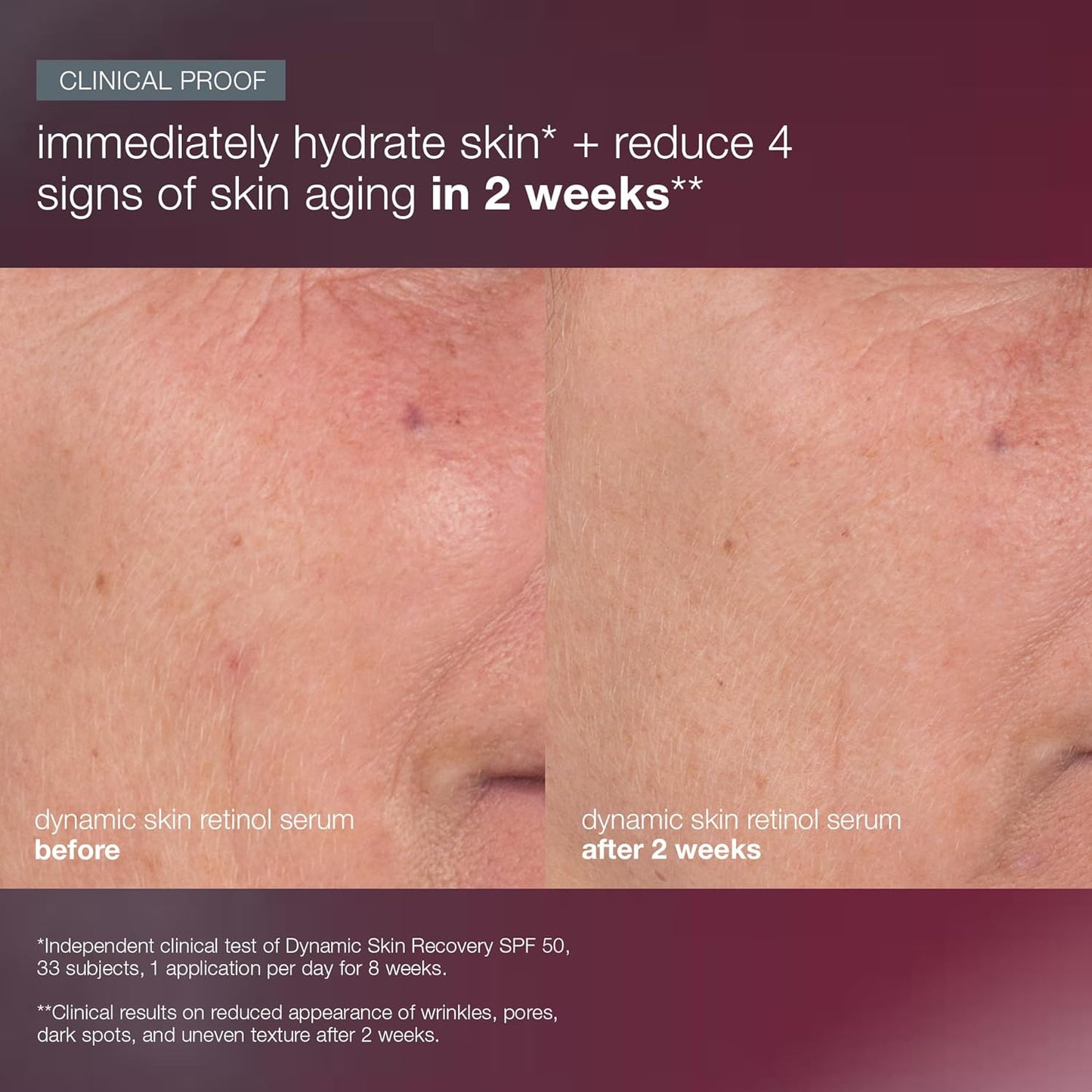 Dermalogica Skin Aging Solutions Kit